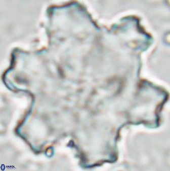 Discoaster kugleri soyhanii 27031