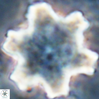 Discoaster soyhanii 27033