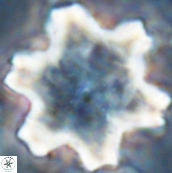 Discoaster kugleri soyhanii 27034