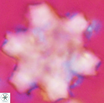 Discoaster soyhanii 27035