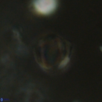 Discoaster leios VR 18736
