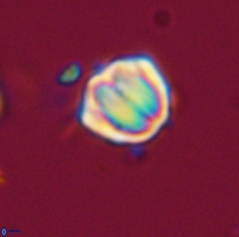Discoaster leios 30159