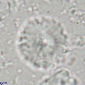 Discoaster lenticularis 42945