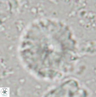 Discoaster lenticularis 42945