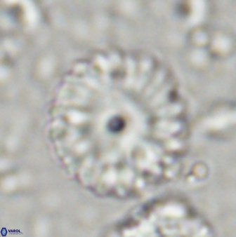 Discoaster lenticularis 42946
