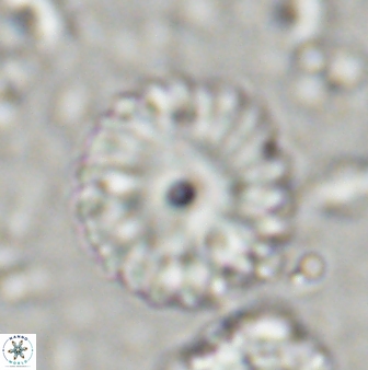 Discoaster lenticularis 42946