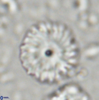 Discoaster lenticularis 42947