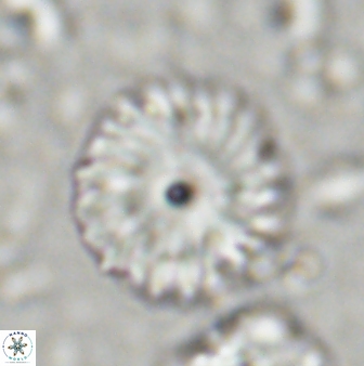 Discoaster lenticularis 42947