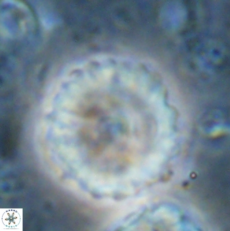 Discoaster lenticularis 42948