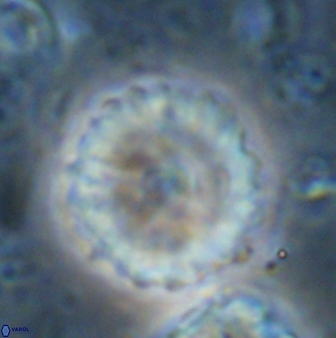 Discoaster lenticularis 42949