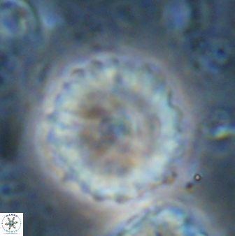 Discoaster lenticularis 42949