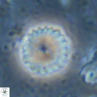 Discoaster lenticularis 43055