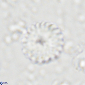 Discoaster lenticularis 43056
