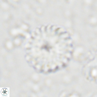 Discoaster lenticularis 43056