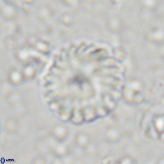 Discoaster lenticularis 43057