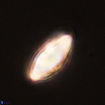 Discoaster lenticularis 57917