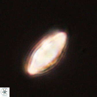 Discoaster lenticularis 57917