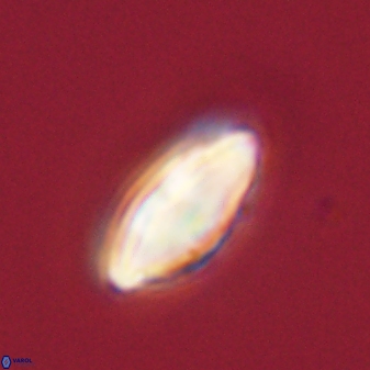 Discoaster lenticularis 57918