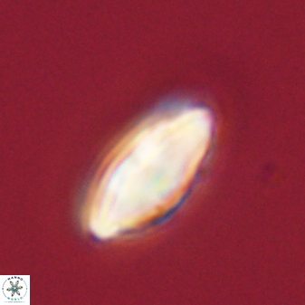 Discoaster lenticularis 57918