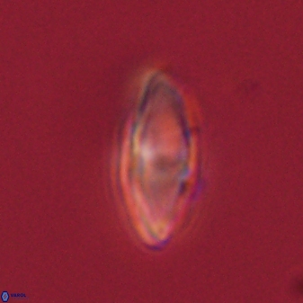 Discoaster lenticularis 57919