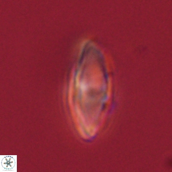 Discoaster lenticularis 57919