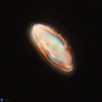 Discoaster lenticularis 57921