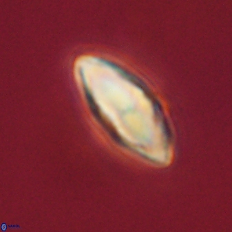 Discoaster lenticularis 57922