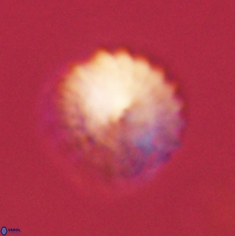 Discoaster lenticularis 57923