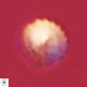 Discoaster lenticularis 57923