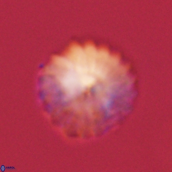 Discoaster lenticularis 57925