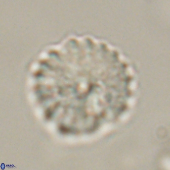 Discoaster lenticularis 57926