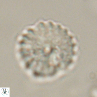 Discoaster lenticularis 57926