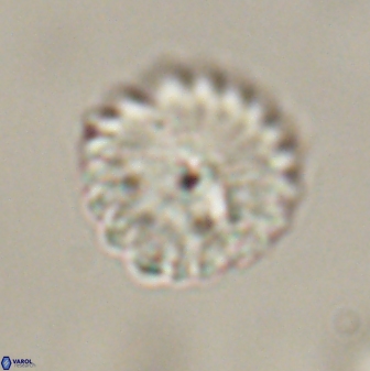 Discoaster lenticularis 57927