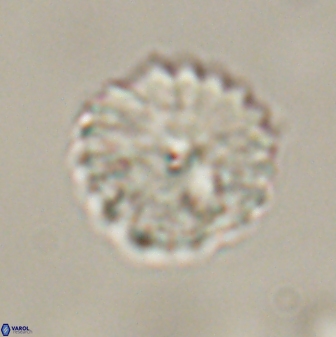 Discoaster lenticularis 57928
