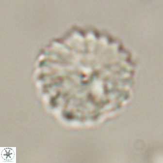 Discoaster lenticularis 57928