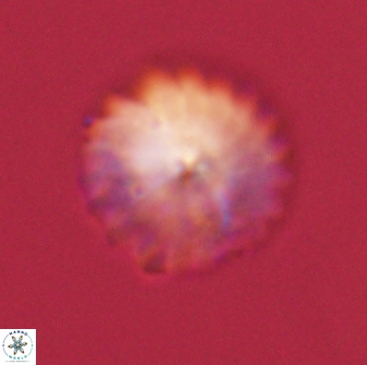 Discoaster lenticularis 57931