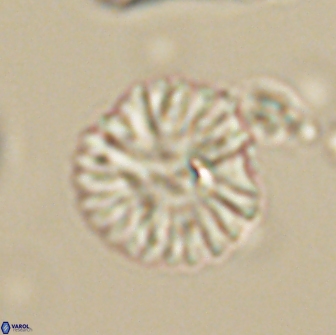 Discoaster lenticularis 64998