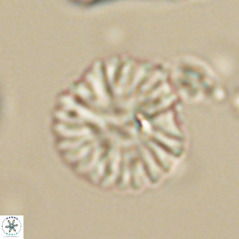 Discoaster lenticularis 64998
