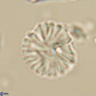 Discoaster lenticularis 64999