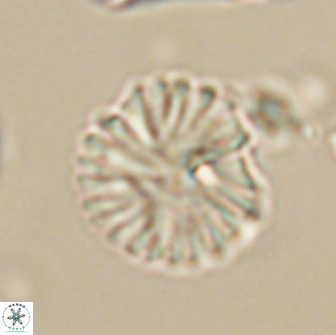 Discoaster lenticularis 64999