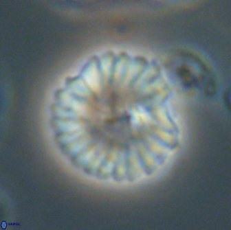 Discoaster lenticularis 65000