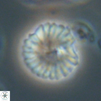 Discoaster lenticularis 65000