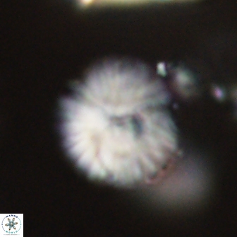 Discoaster lenticularis 65001
