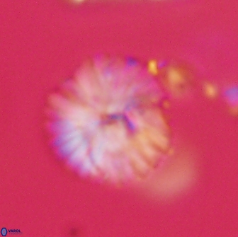 Discoaster lenticularis 65002