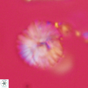 Discoaster lenticularis 65002