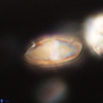 Discoaster lenticularis 65004