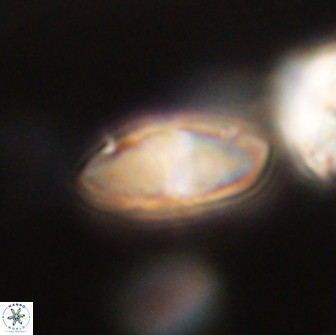 Discoaster lenticularis 65004