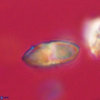Discoaster lenticularis 65005