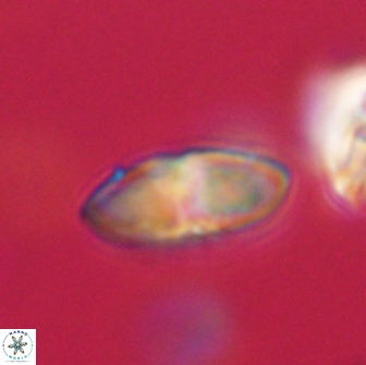 Discoaster lenticularis 65005