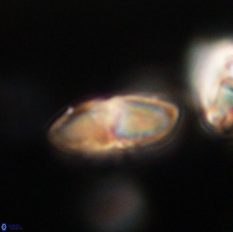 Discoaster lenticularis 65006